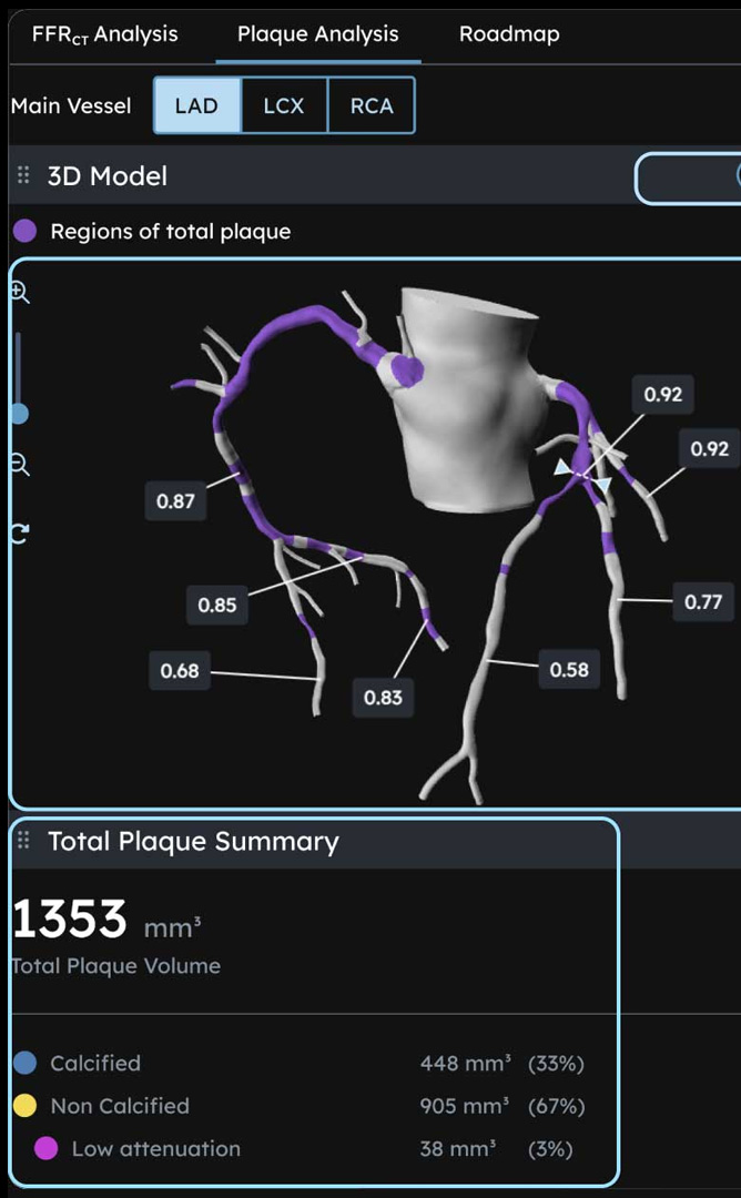 How Plaque Analysis Works diagram