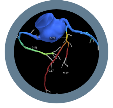 circle ffrct analysis